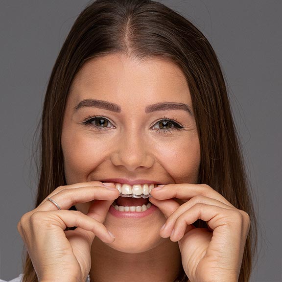Dr. Töpfer Erwachsene Frau Invisalign Modell Privatpraxis Wiesbaden